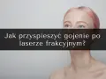 Kobieta z różowymi włosami, pytająca jak przyspieszyć gojenie po laserze frakcyjnym.