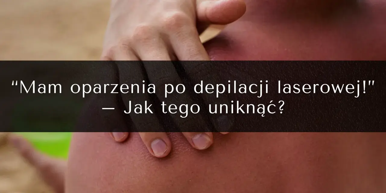 Oparzenia po depilacji laserowej to częsty problem. Zobacz, jak uniknąć powikłań i jakie są opinie o zabiegu.