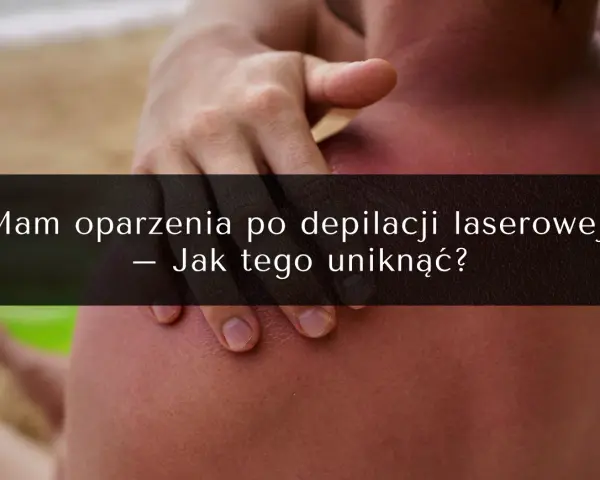 Oparzenia po depilacji laserowej to częsty problem. Zobacz, jak uniknąć powikłań i jakie są opinie o zabiegu.