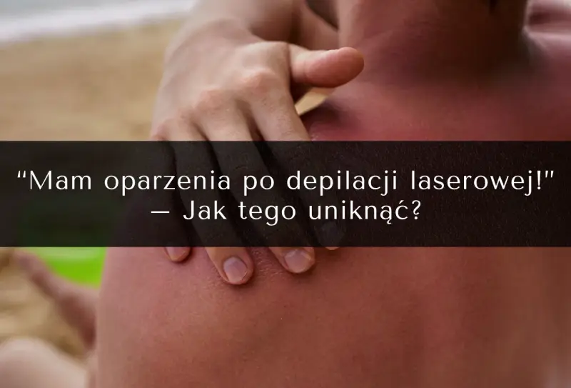Oparzenia po depilacji laserowej to częsty problem. Zobacz, jak uniknąć powikłań i jakie są opinie o zabiegu.
